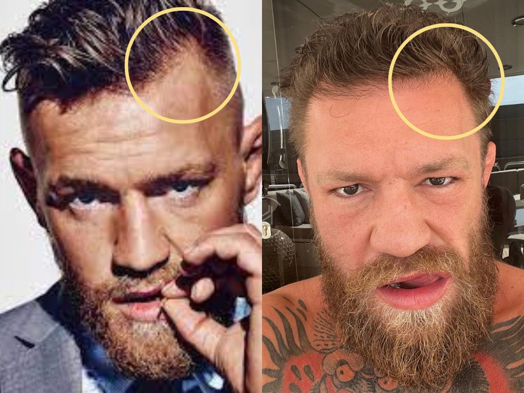 Conor Mcgregor Hair Braided: 10 Best Long Hair Conor McGregor Haircut
